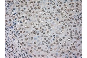 Image no. 1 for anti-Cancer/testis Antigen 1B (CTAG1B) antibody (ABIN1499899) (CTAG1B Antikörper)