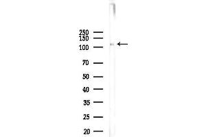 anti-Disabled Homolog 1 (Drosophila) (DAB1) (pTyr220) antibody