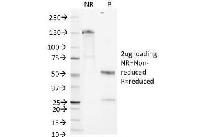 SDS-PAGE Analysis Purified CD1b Mouse Monoclonal Antibody (RIV12). (CD1b Antikörper)