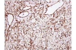 Immunohistochemistry (IHC) image for anti-Clusterin (CLU) (AA 1-333), (N-Term) antibody (ABIN317504) (Clusterin Antikörper  (N-Term))