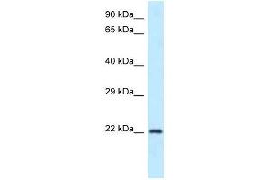 Western Blot showing Guk1 antibody used at a concentration of 1. (GUK1 Antikörper  (N-Term))