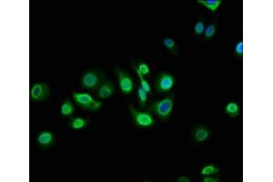 Immunofluorescence staining of HepG2 cells with ABIN7172938 at 1:133, counter-stained with DAPI.