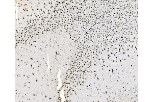 IHC analysis of JUNB using anti-JUNB antibody (ABIN7603223). (JunB Antikörper  (N-Term))