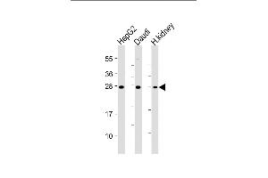 All lanes : Anti-HAVCR2 Antibody at 1:4000 dilution Lane 1: HepG2 whole cell lysate Lane 2: Daudi whole cell lysate Lane 3: Human kidney lysate Lysates/proteins at 20 μg per lane. (TIM3 Antikörper)