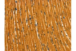 Phospho-RAB7L1 (Thr71) Antibody at 1/100 staining Rat heart tissue by IHC-P. (RAB7L1 Antikörper  (pThr71))
