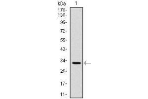 Western Blotting (WB) image for anti-Tumor Necrosis Factor Receptor Superfamily, Member 8 (TNFRSF8) antibody (ABIN969019)