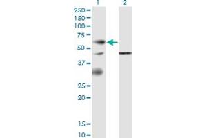 Western Blot analysis of EPOR expression in transfected 293T cell line by EPOR monoclonal antibody (M02), clone 3F6. (EPOR Antikörper  (AA 31-130))