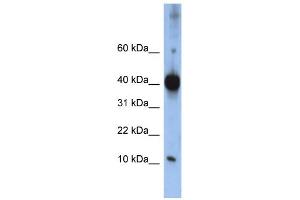WB Suggested Anti-LSM4 Antibody Titration:  0. (LSM4 Antikörper  (Middle Region))