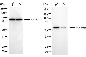 Western blotting analysis using vimentin antibody (ABIN7800836).