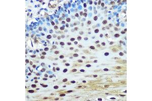 Immunohistochemistry of paraffin-embedded human esophageal using hnRNP K Rabbit mAb (ABIN7267634) at dilution of 1:100 (40x lens). (HNRNPK Antikörper)