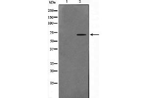 Western blot analysis on A549 cell lysate using CERKL Antibody,The lane on the left is treated with the antigen-specific peptide. (CERKL Antikörper  (Internal Region))