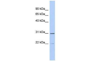 ZCCHC13 antibody used at 1 ug/ml to detect target protein. (ZCCHC13 Antikörper  (Middle Region))