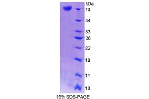 SDS-PAGE (SDS) image for Cartilage Associated Protein (CRTAP) (AA 26-400) protein (His tag,GST tag) (ABIN4990799)