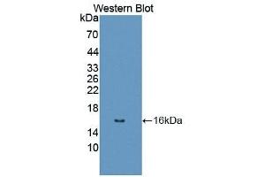 Detection of Recombinant DRD1, Human using Polyclonal Antibody to Dopamine Receptor D1 (DRD1) (Dopamine Receptor d1 Antikörper  (AA 338-446))