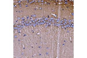 IHC analysis of SH3GL2 using anti-SH3GL2 antibody (ABIN7602229). (SH3G2 Antikörper  (AA 65-292))