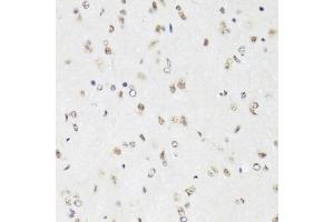 Immunohistochemistry of paraffin-embedded mouse brain using EFTUD2 Antibody (ABIN5974236) at dilution of 1/100 (40x lens). (EFTUD2 Antikörper)