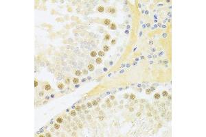 Immunohistochemistry (Paraffin-embedded Sections) (IHC (p)) image for anti-Replication Factor C (Activator 1) 4, 37kDa (RFC4) (AA 204-363) antibody (ABIN6146881)