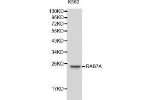 Western blot analysis of extracts of K-562 cells, using RAB7A antibody (ABIN5970501). (RAB7A Antikörper)