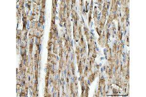 IHC analysis of NDUFS5 using anti-NDUFS5 antibody (ABIN7598943).