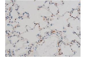 ABIN6267411 at 1/200 staining Rat lung tissue sections by IHC-P. (JunD Antikörper  (pSer255))