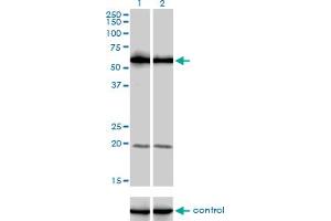 Western Blotting (WB) image for anti-phosphoinositide Kinase, FYVE Finger Containing (PIKFYVE) (AA 342-452) antibody (ABIN599337) (PIKFYVE Antikörper  (AA 342-452))