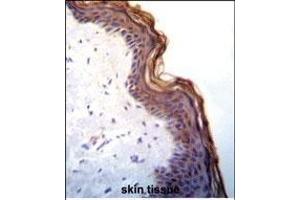 Kallikrein 7(KLK7) Antibody (C-term) (ABIN652198 and ABIN2840744) immunohistochemistry analysis in formalin fixed and paraffin embedded human skin tissue followed by peroxidase conjugation of the secondary antibody and DAB staining.