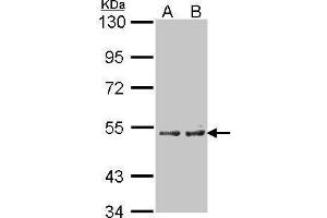 WB Image Sample(30 μg of whole cell lysate) A:A431, B:H1299 7. (CYP4A11 Antikörper  (Center))