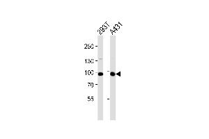 Western blot analysis of lysates from 293T, A431 cell line (from left to right), using IL4R Antibody at 1:1000 at each lane. (IL-4 Antikörper  (C-Term))