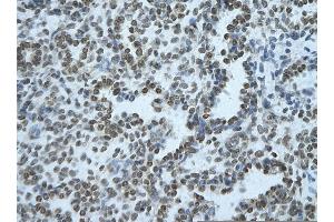 Rabbit Anti-BHLHE40 Antibody       Paraffin Embedded Tissue:  Human alveolar cell   Cellular Data:  Epithelial cells of renal tubule  Antibody Concentration:   4. (BHLHE40 Antikörper  (Middle Region))