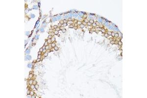 Immunohistochemistry of paraffin-embedded mouse testis using CTNNA1 antibody. (CTNNA1 Antikörper)