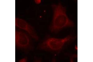 Immunofluorescence staining of methanol-fixed Hela cells using NFkB-p105(Phospho-Ser927) Antibody. (NFKB1 Antikörper  (pSer927))