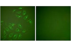 Immunofluorescence (IF) image for anti-Matrix Metallopeptidase 13 (Collagenase 3) (MMP13) (AA 10-59) antibody (ABIN2889227) (MMP13 Antikörper  (AA 10-59))