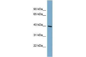 WB Suggested Anti-ST8SIA6 Antibody Titration:  0. (ST8SIA6 Antikörper  (Middle Region))