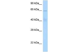 WB Suggested Anti-STAM Antibody Titration: 1. (STAM Antikörper  (N-Term))