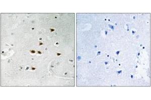 Immunohistochemistry analysis of paraffin-embedded human brain, using ITCH (Phospho-Tyr420) Antibody. (ITCH Antikörper  (pTyr420))