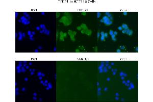 Sample Type :  HCT116   Primary Antibody Dilution:  4 ug/ml   Secondary Antibody :  Anti-rabbit Alexa 546   Secondary Antibody Dilution:  2 ug/ml   Gene Name :  TFDP1 (DP1 Antikörper  (N-Term))