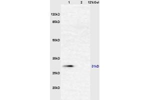 Lane 1: mouse liver lysates Lane 2: mouse intestine lysates probed with Anti AHSG/Fetuin A/Alpha 2 HS Glycoprotein Polyclonal Antibody, Unconjugated (ABIN681733) at 1:200 in 4 °C. (Fetuin A Antikörper  (AA 201-300))