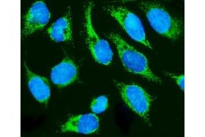 anti-Holocytochrome C Synthase (HCCS) (AA 76-268) antibody