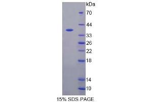 SDS-PAGE analysis of Mouse S17aH Protein. (CYP17A1 Protein)