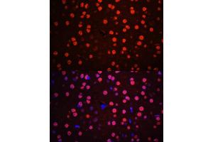 Immunofluorescence analysis of mouse brain using Phospho-p38 MAPK-T180/Y182 antibody (ABIN6135257, ABIN6136138, ABIN6136139 and ABIN6225556) at dilution of 1:100. (MAPK14 Antikörper  (pThr180, pTyr182))