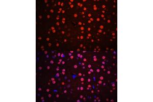 Immunofluorescence analysis of mouse brain using Phospho-p38 MAPK-T180/Y182 antibody (ABIN6135257, ABIN6136138, ABIN6136139 and ABIN6225556) at dilution of 1:100. (MAPK14 Antikörper  (pThr180, pTyr182))