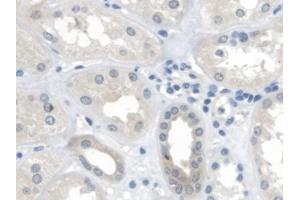 Detection of MTUS1 in Human Kidney Tissue using Polyclonal Antibody to Mitochondrial Tumor Suppressor 1 (MTUS1) (MTUS1 Antikörper  (AA 1018-1270))
