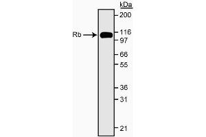 Western blot analysis of Rb. (Retinoblastoma 1 Antikörper  (C-Term))