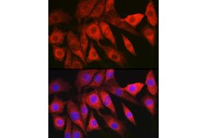 Immunofluorescence analysis of NIH/3T3 cells using L Rabbit pAb (ABIN6130466, ABIN6143085, ABIN6143086 and ABIN6219719) at dilution of 1:200 (40x lens).