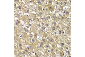 Immunohistochemistry of paraffin-embedded human liver injury using MYBPC2 antibody at dilution of 1:100 (x40 lens).