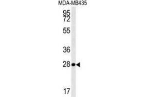 Western blot analysis in MDA-MB435 cell line lysates (35ug/lane) using MRM1 Antibody (N-term). (MRM1 Antikörper  (N-Term))
