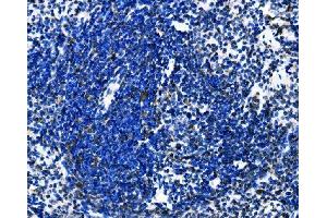 IHC analysis of Dectin-1/Clec7a using anti-Dectin-1/Clec7a antibody (ABIN7600251).