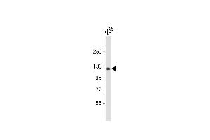 Anti-COL1A2 Antibody (N-term) at 1:1000 dilution + 293 whole cell lysate Lysates/proteins at 20 μg per lane. (COL1A2 Antikörper  (N-Term))