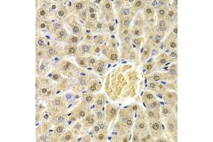 Immunohistochemistry (Paraffin-embedded Sections) (IHC (p)) image for anti-RAD9 Homolog A (S. Pombe) (RAD9A) (AA 162-391) antibody (ABIN3022652)