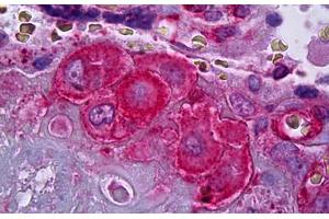 Anti-SERPINE1 / PAI-1 antibody IHC staining of human placenta, decidual cells. (PAI1 Antikörper)